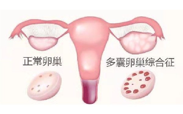 试管婴儿怎么移植胚胎附上常见方式解析