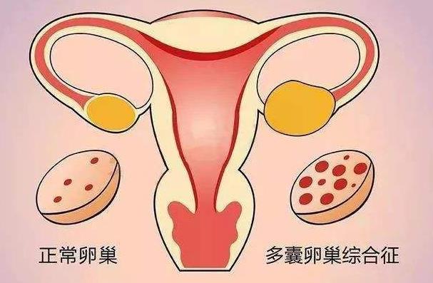 泰国做试管囊胚培养与移植的优势您了解吗