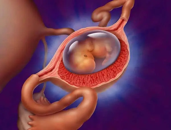 试管婴儿时多囊卵巢综合症患者需要注意哪些事项内附身体调理