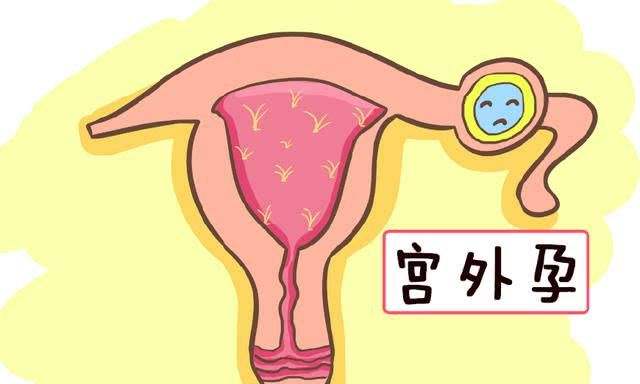 赴日本做试管婴儿前需要提前了解什么，这4种不同套餐费用的区别