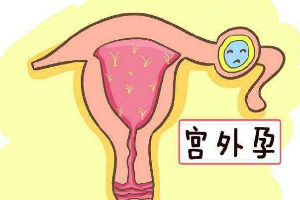 息肉影响大应治疗后再泰国试管婴儿助孕