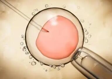 只取一颗卵子也能做试管婴儿，卵泡质量是成功的关键