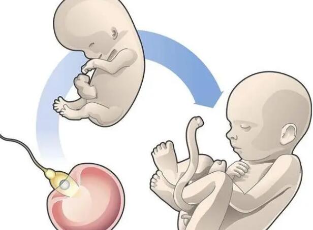 泰国试管婴儿双胞胎几率大吗存在着哪些风险